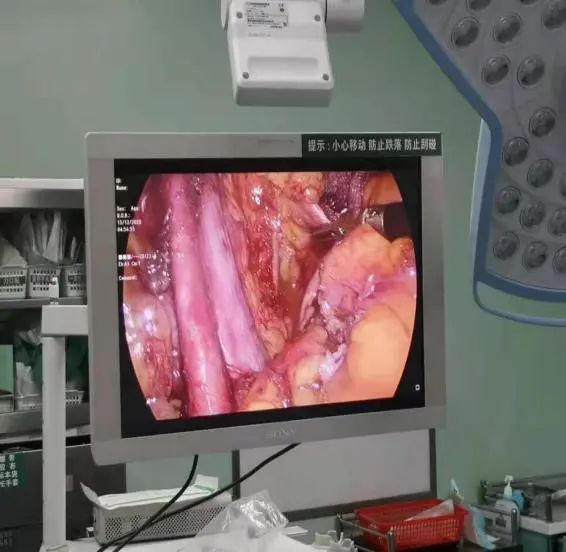 微创最新技术,微创再创新