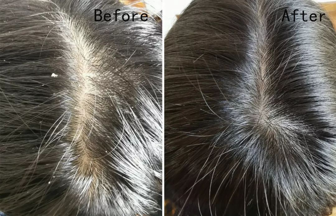 4周瘦20斤食谱,4周瘦30斤高效减脂餐