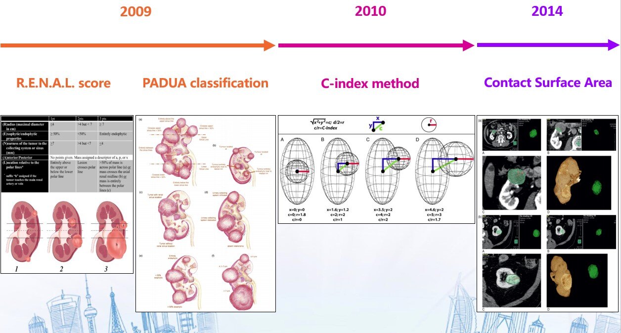 目前治愈肾癌的最好方法,早期肾癌的最新治疗方法