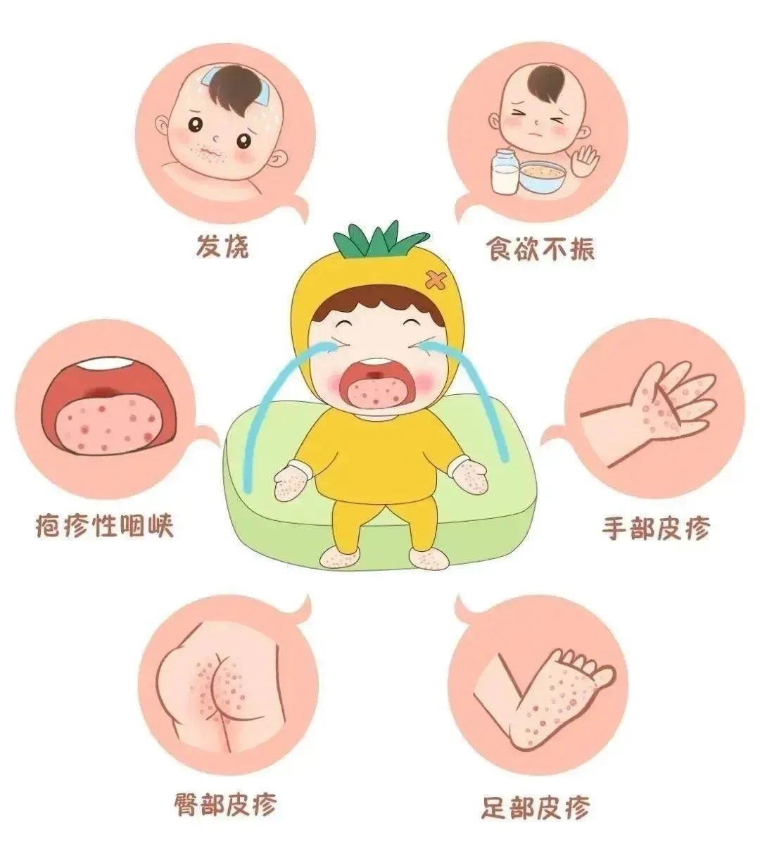 小孩发烧无症状查血说是病毒感染,手足口病发烧了但没有长疱疹