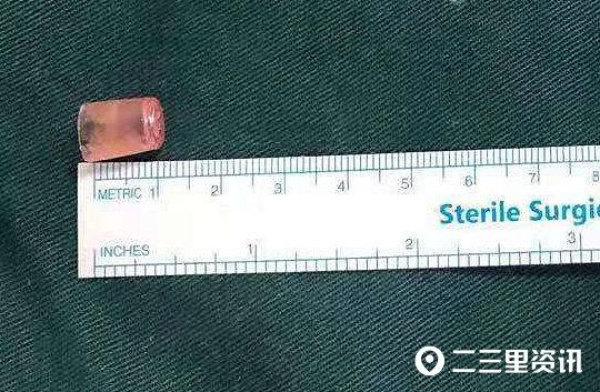 小孩误吞笔帽怎么办,小孩误吞笔帽吃什么能拉下来