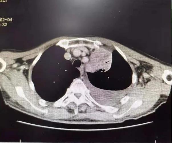 西安市胸科医院呼吸科专家,西安市胸科医院呼吸与危重症医学