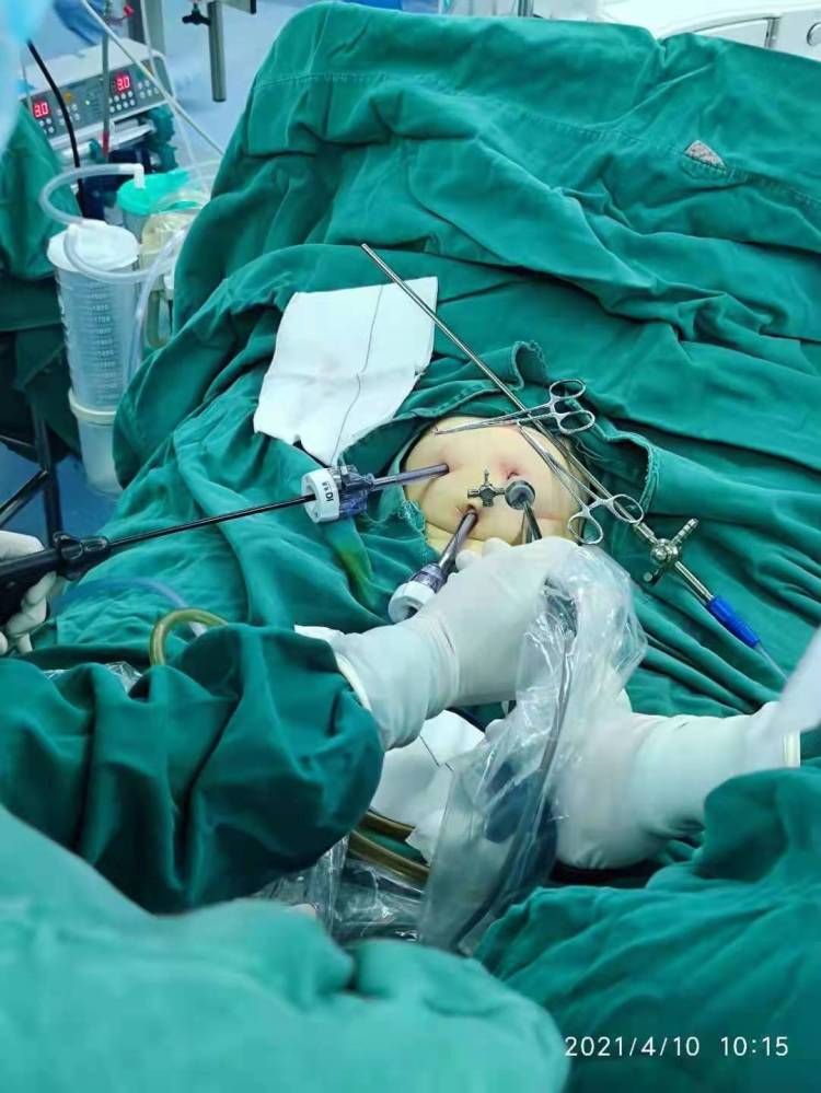 腹腔脏器修补术有哪些,腹腔镜空腔脏器修补术