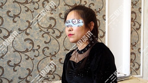 花几千块钱去美容院治痘会好吗,花2万元祛斑彻底祛除了值得吗