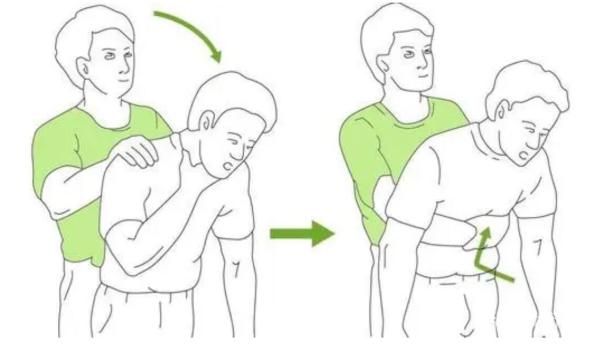 儿童意外伤害急救知识,儿童意外伤害怎么急救