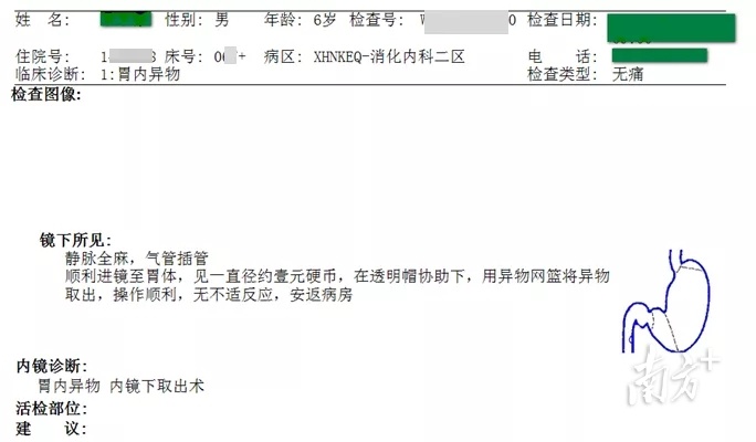 六岁小孩误吞硬币要怎么处理,儿童误吞硬币5天了还没排出来
