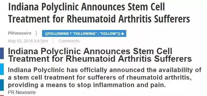 干细胞移植能治好类风湿关节炎吗,类风湿性关节炎最新研究热点