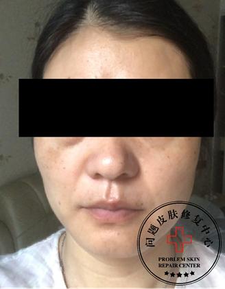 st皮肤问题修复中心,st皮肤修复中心在哪里