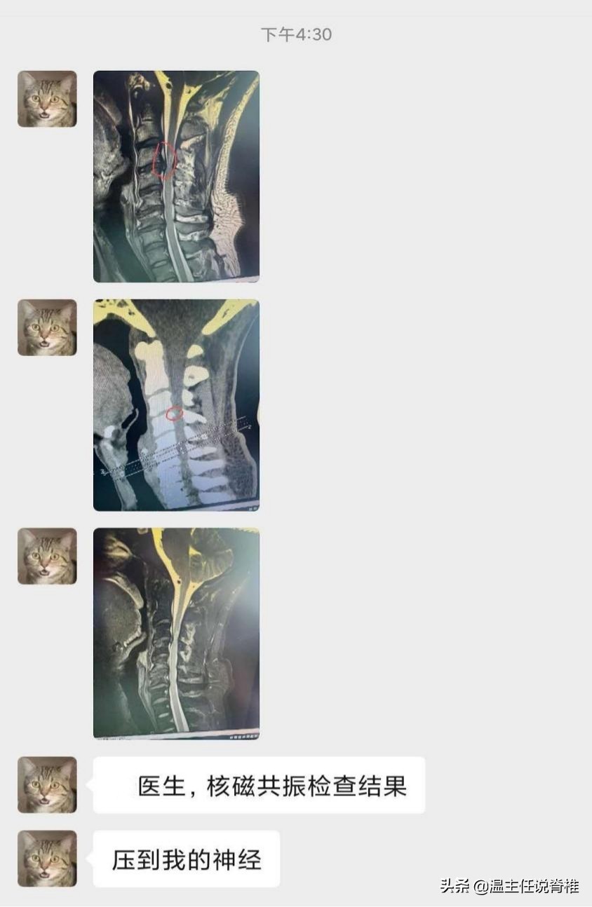 外科医生做脊椎手术,脊椎病保守治疗