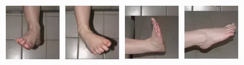 孩子脚扭伤了肿了怎么擦药水,小孩脚扭伤后热敷了怎么办