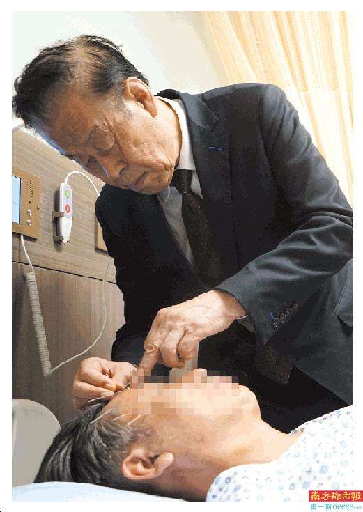 针灸学习方法视频大全,初学针灸正规操作的视频