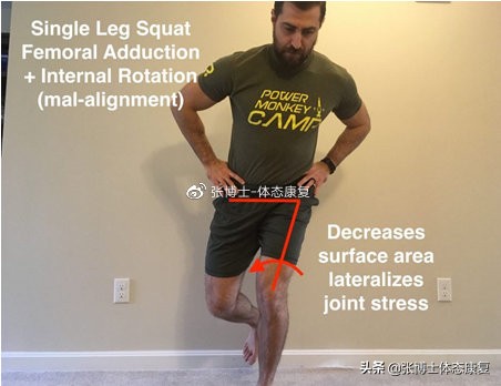 髌骨关节疼痛综合症怎么治,髌骨疼痛综合症的辅助疗法