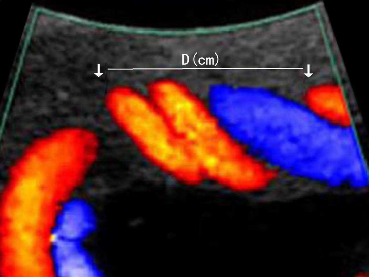 做彩超可以看出来脐带多长吗,超声检查脐带绕颈一圈正常吗