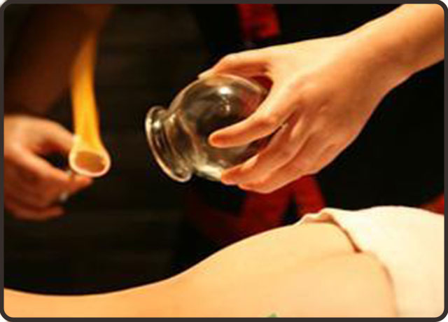 拔火罐关注事项和禁忌,高血压拔火罐关注事项