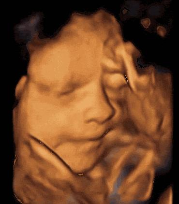 胎儿怎么在娘胎里排泄,胎儿在娘胎里能看见什么