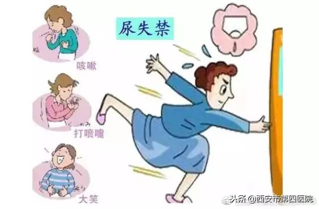 盆底肌最好的态势是怎么样的,了解盆底肌生物反馈治疗的要点