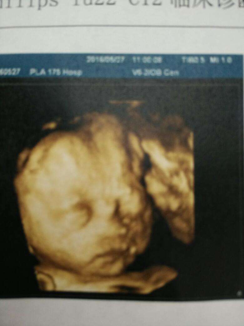 第一次胎动妈妈做什么好,妈妈感受到胎动的时候