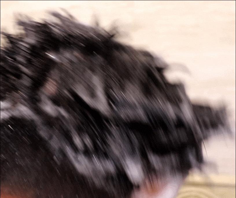 洗发水推荐发际线前移,公认最有效的生发洗发水