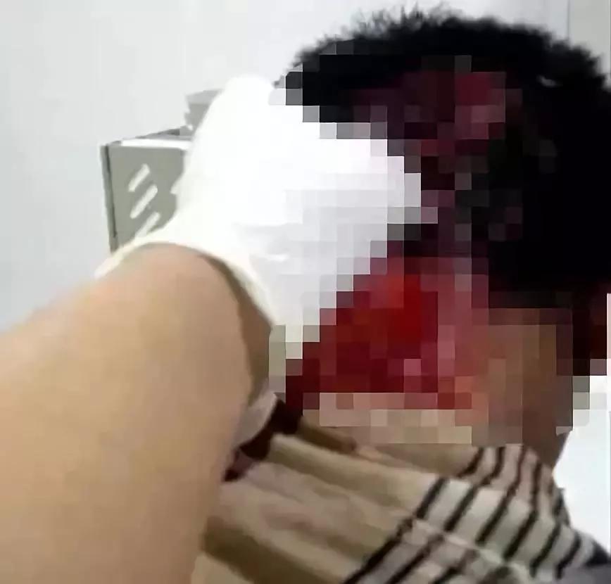 手机半夜充电突然发烫,手机半夜充电烧了怎么办