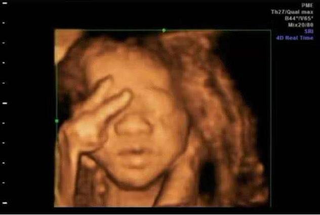 生活在宫腔“小黑屋”里，宝宝们每天都干嘛？看完感觉有点可爱