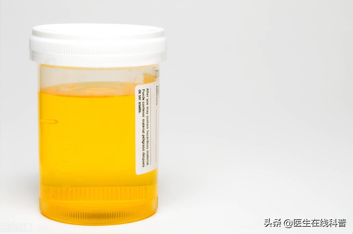 肾病综合征尿蛋白转阴还用吃药吗,膜性肾病尿蛋白转阴后易复发