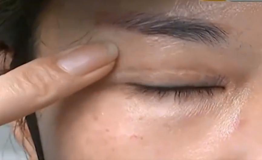 花了三十万割双眼皮河南医院,花了一万五割双眼皮