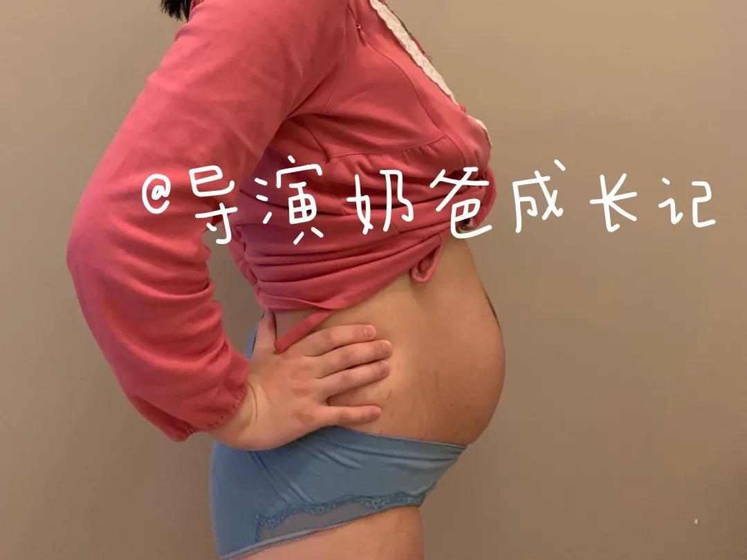 三指半到闭合，一个双胞胎妈妈的腹直肌康复之路