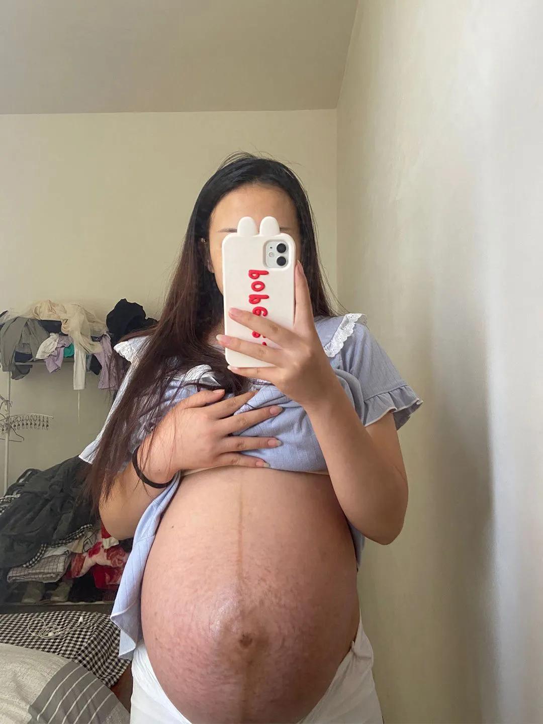 产后42天子宫脱垂可以用收腹带吗,收腹带影响子宫