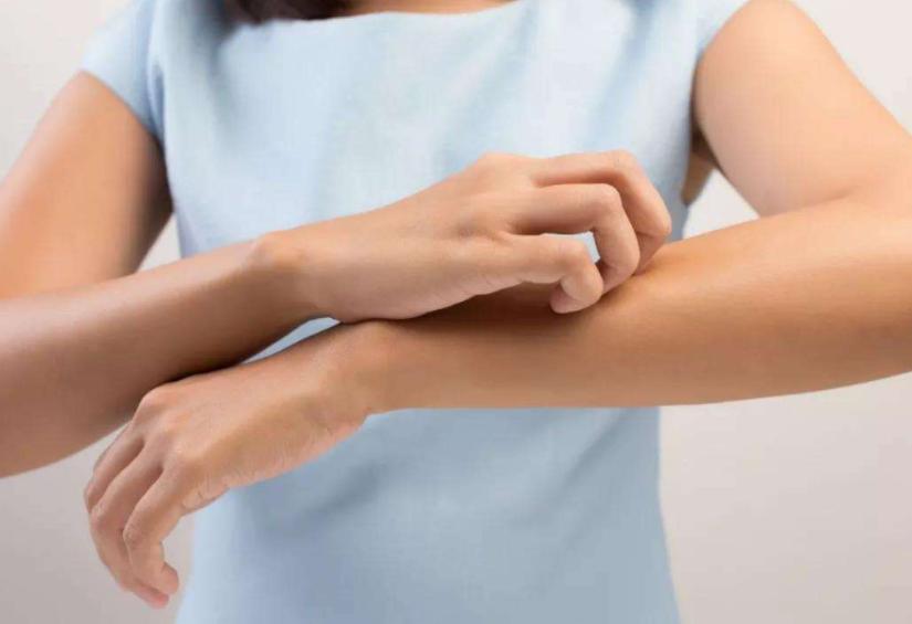 身体干燥起皮用哪种凡士林身体乳,冬天皮肤干可以涂甘油加面霜吗