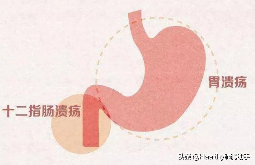 肺癌患者胃痛什么原因,肺癌晚期出现胃疼是什么原因