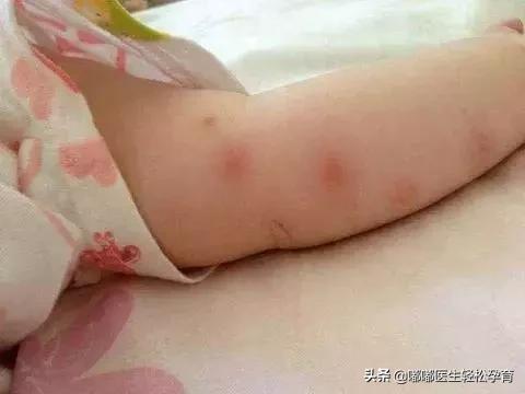 润本驱蚊液这个牌子怎么样,儿童无毒驱蚊液哪个品牌好