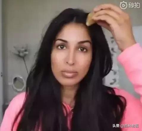 脱发严重怎样挽回发际线,发际线警告拯救脱发