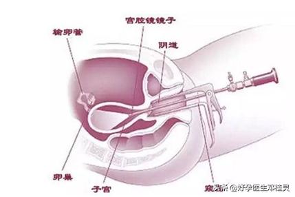 备孕胸透的危害有多大,纵隔子宫怀孕需要关注什么