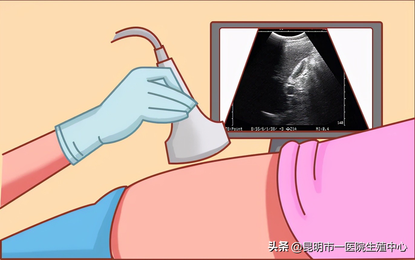 判断女人是否拥有高质量卵子，主要就看这三点