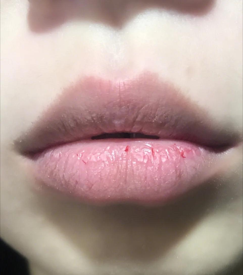 嘴唇好丑怎么变好看,嘴唇为何会越变越难看