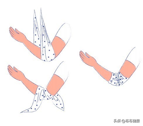 专家级指导：外伤后如何包扎伤口