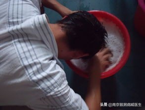 用洗洁精洗头会得银屑病,洗洁精洗头男孩