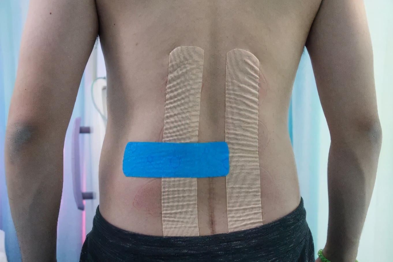 弹性贴布的原理,弹性贴布的作用