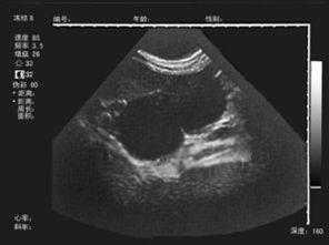 母猪返情什么意思,母猪戒奶后几天返情