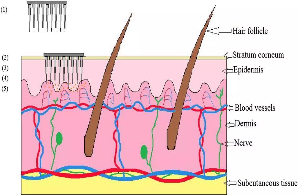 鼻翼毛孔粗大怎么上粉底,鼻翼两侧毛孔粗大卡粉怎么解决