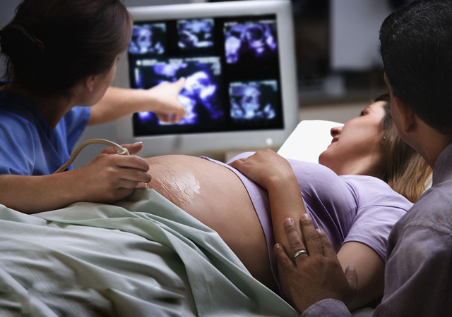 产检胎儿出生了,产检发现怀孕双胞胎