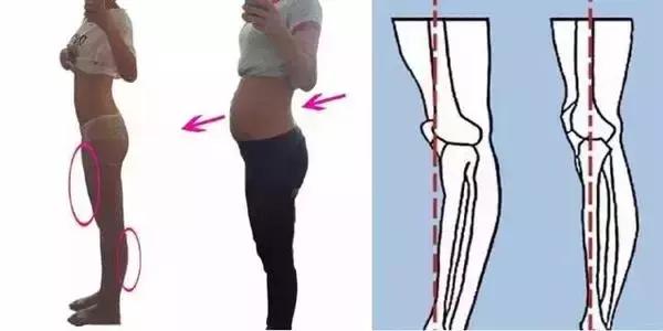 屁股大假胯宽大腿粗最快改善,屁股大假胯宽怎么办