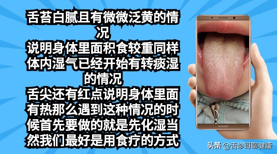 舌诊哥聊血瘀,抖音舌诊哥的感悟