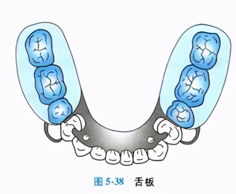 牙列缺损的可摘局部义齿修复题库,牙科美学修复精讲
