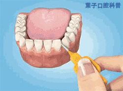 牙齿缺失后不镶牙有啥危害,牙齿缺失后不补有什么危害