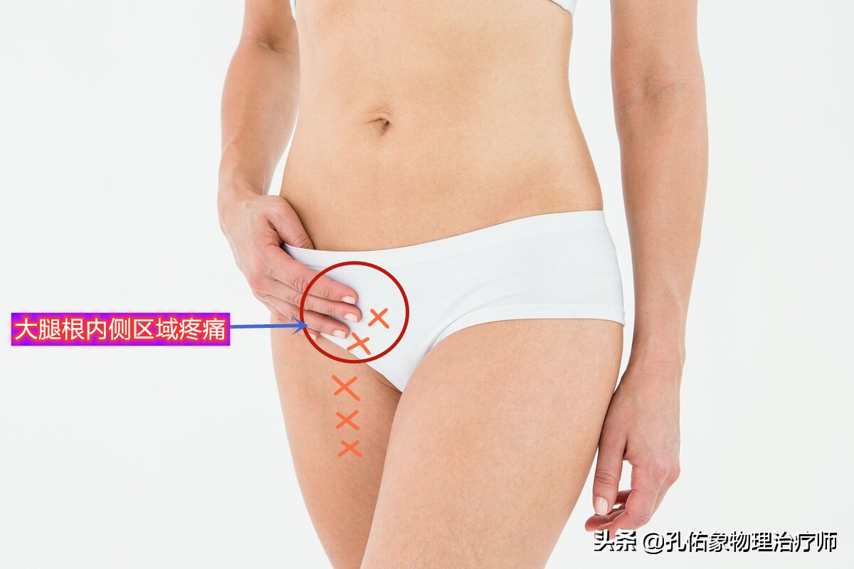 女大腿根内侧疼痛是什么原因,女性左大腿内侧根部疼是怎么回事