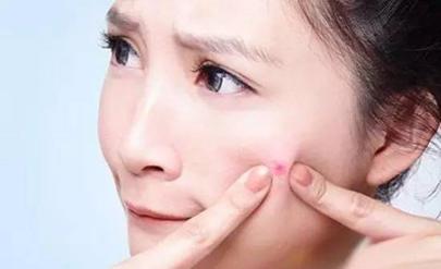 痘痘过了年纪还会长吗,青春期的痘痘怎么能治好