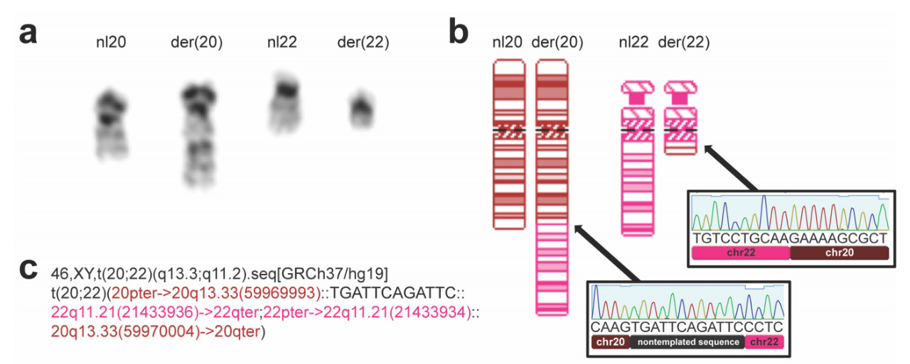 新突破！又一男性不育基因被发现，有望解决男性不育问题