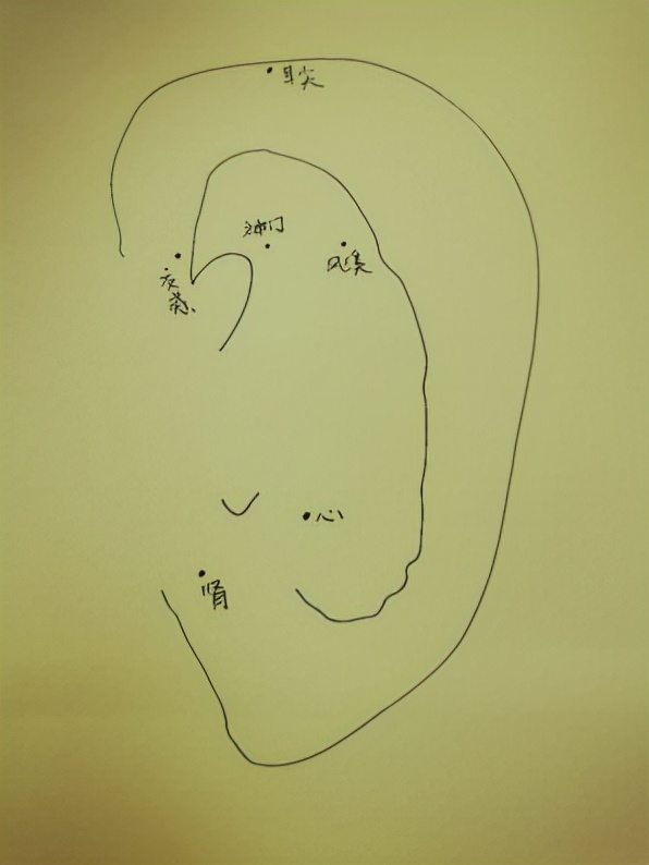 “肛”湖问道|动动小耳朵，身体百病消