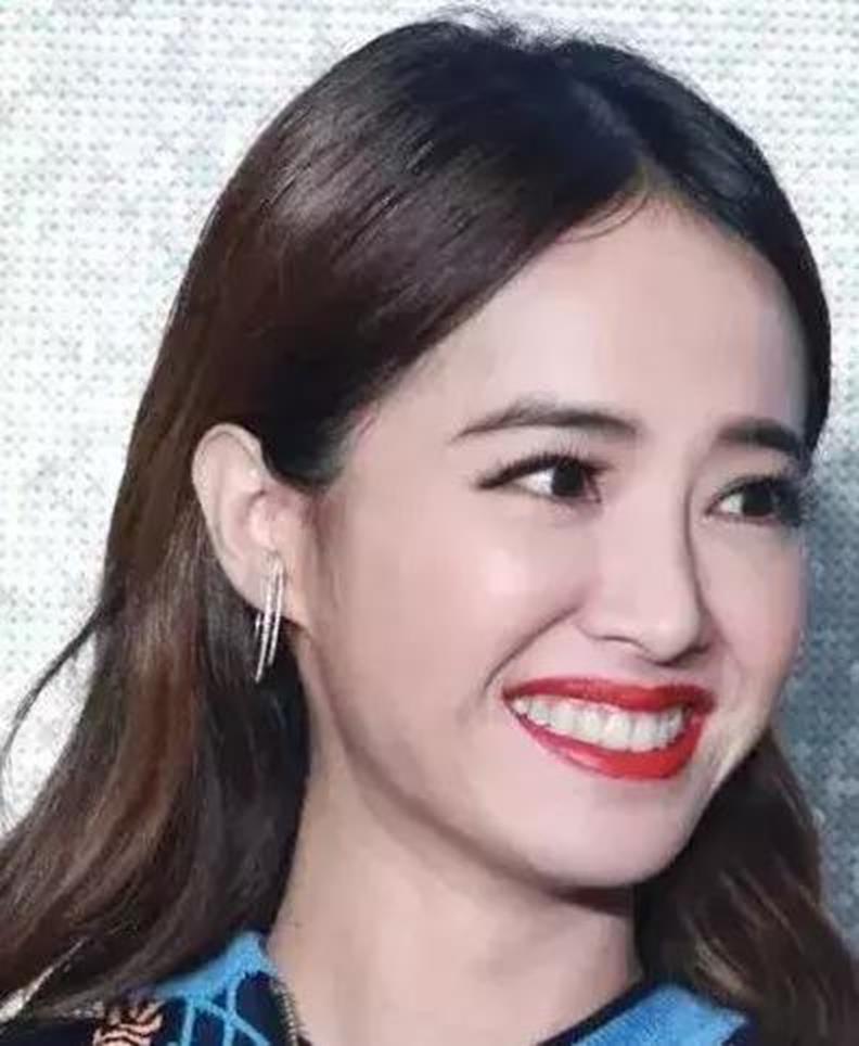 脸上有法令纹去不掉太难看了，这样做消除法令纹，让你越来越年轻